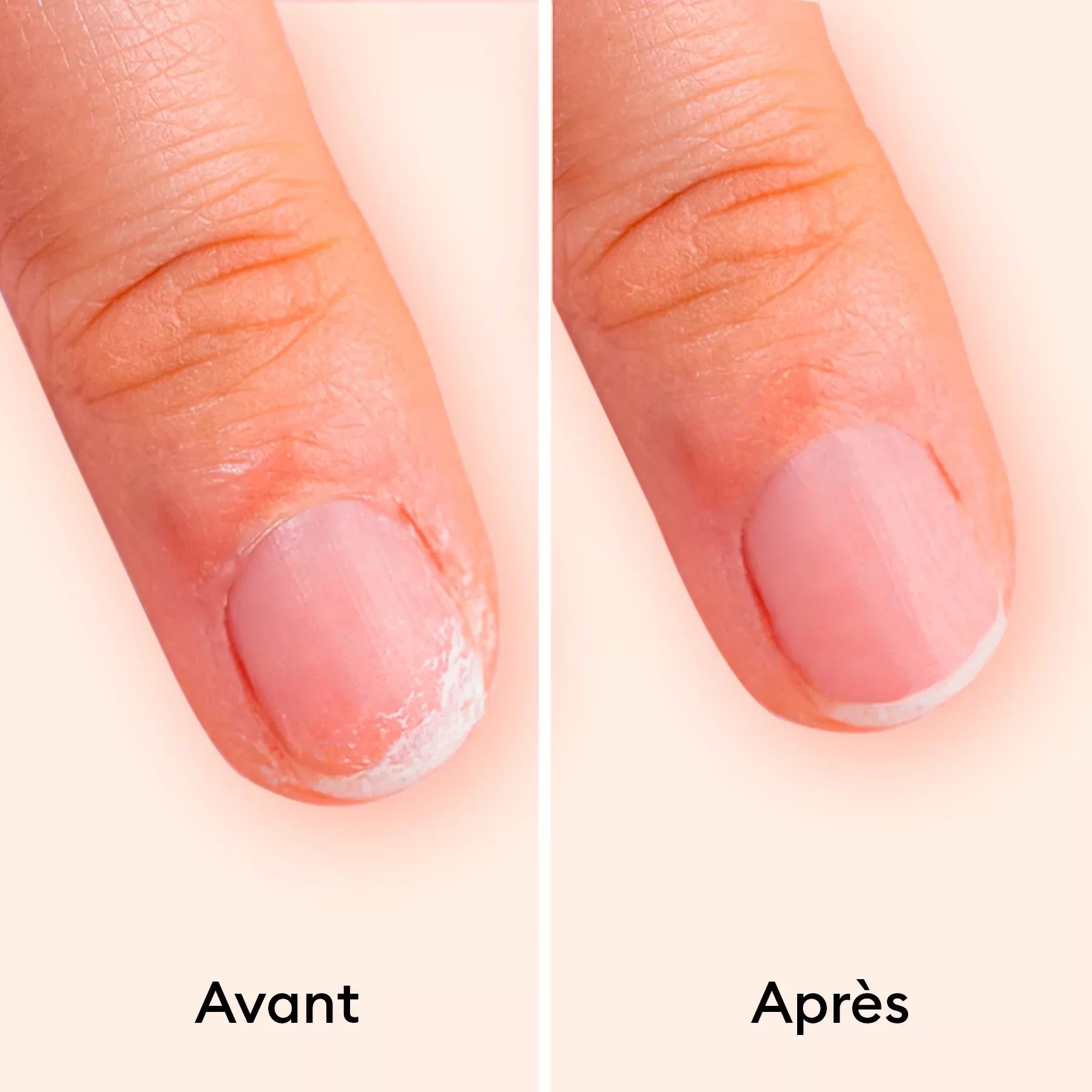 Vernis Kératine booster - 15ml