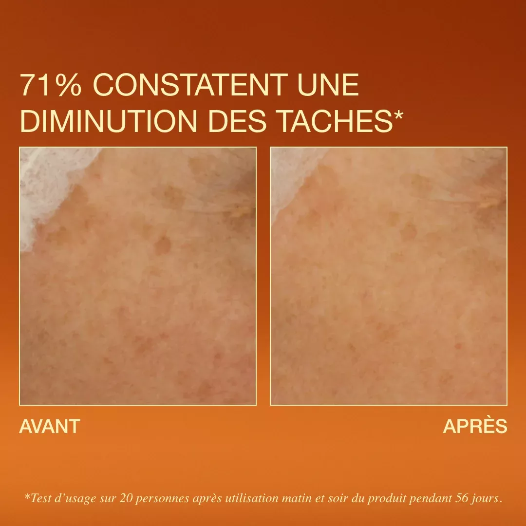 Sérum éclat - Anti-tâches - 30ml